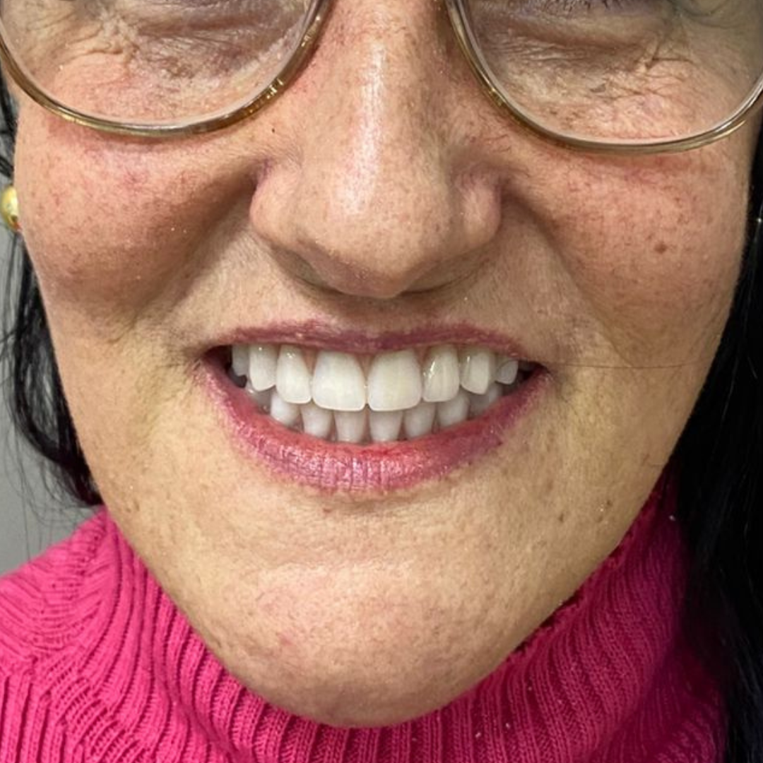 oral unic guapore - antes e depois (2)