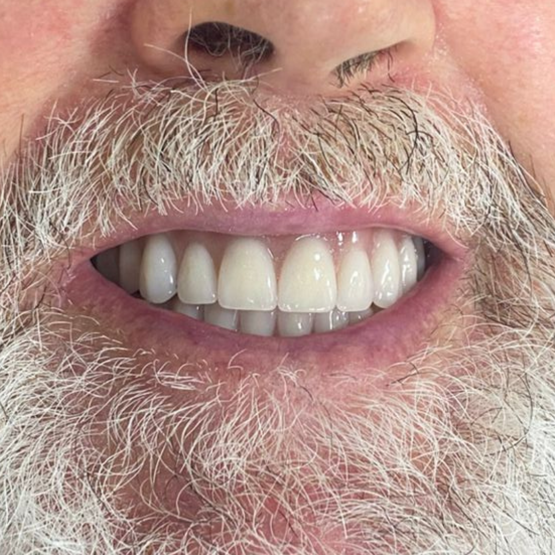 oral unic guapore - antes e depois (3)