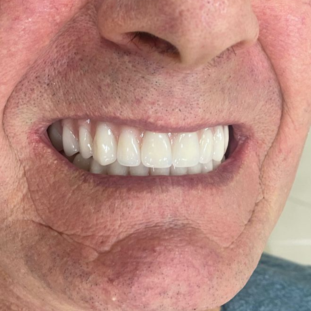 oral unic guapore - antes e depois (4)