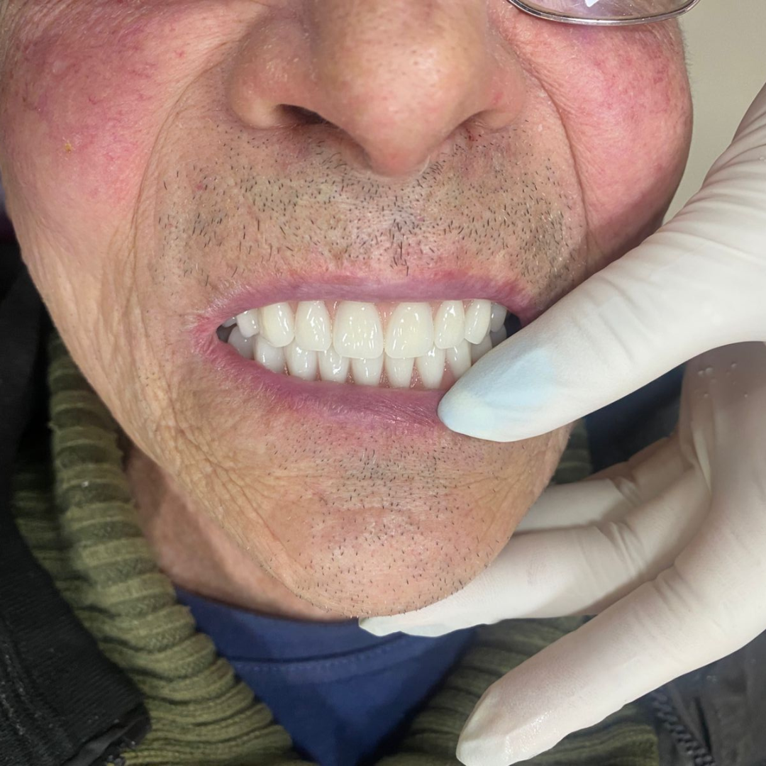 oral unic guapore - antes e depois (5)